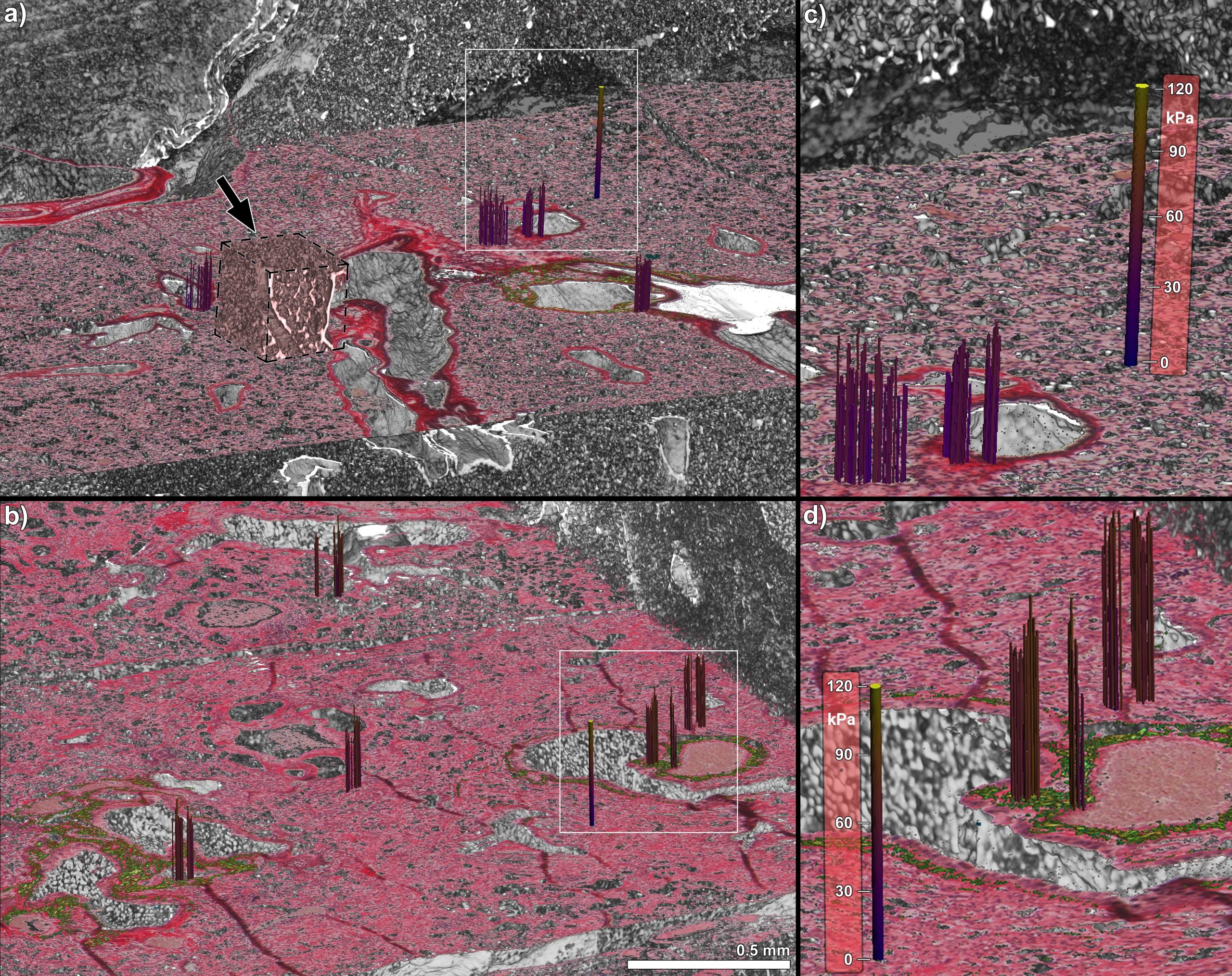Press release a multi modal analysis to characterise fibrotic tissues